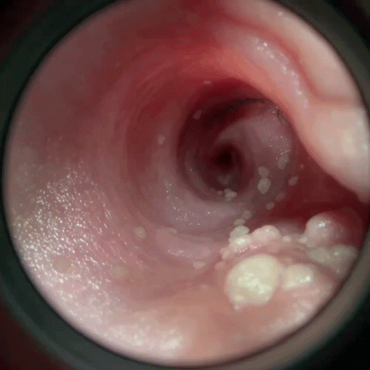 Waxby™ HD Ear Camera